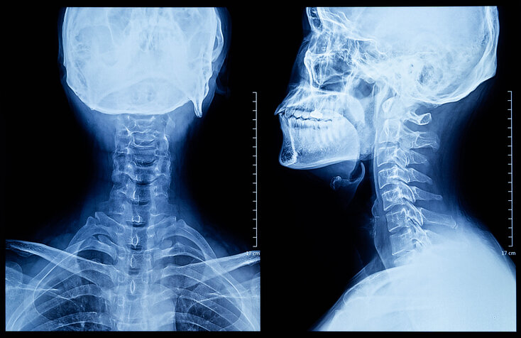 Le rachis en neuroradiologie: techniques diagnostiques et interventionnelles essentielles