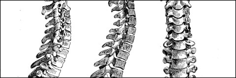 Les douleurs du membre supérieur liées au rachis cervical: du bilan au traitement
